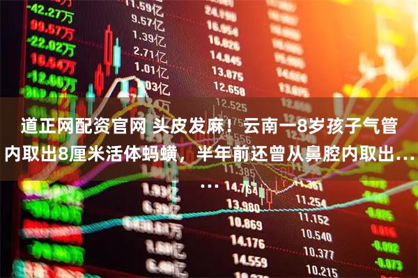 道正网配资官网 头皮发麻!云南一8岁孩子气管内取出8厘米活体蚂蟥,半年前还曾从鼻腔内取出…